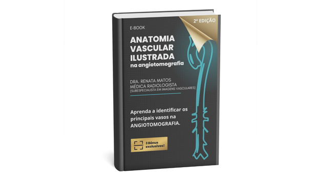 Anatomia Vascular no estudo de Angiotomografia. 2ª edição