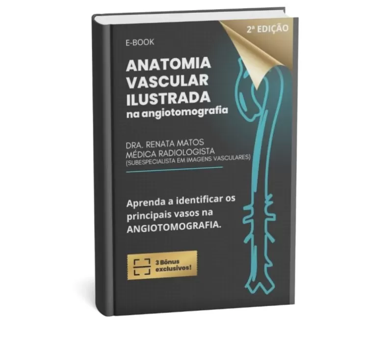 Anatomia Vascular no estudo de Angiotomografia. 2ª edição