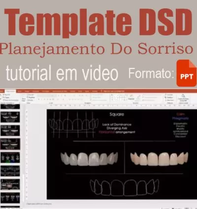 Template DSD - Planejamento do Sorriso para PowerPoint: Eleve Suas Apresentações Odontológicas!