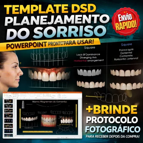 Template DSD - Planejamento do Sorriso para PowerPoint: Eleve Suas Apresentações Odontológicas!