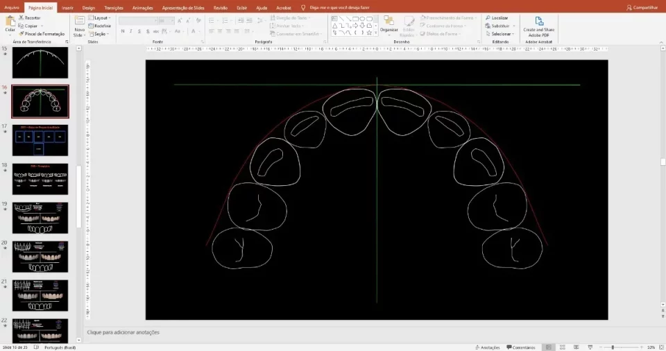 Template DSD - Planejamento do Sorriso para PowerPoint: Eleve Suas Apresentações Odontológicas!